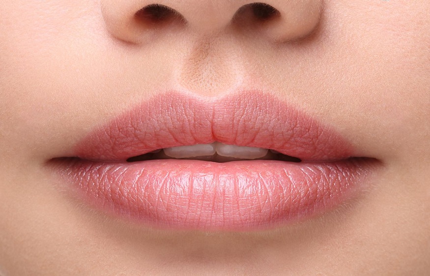 Cosmetic surgery of the lips