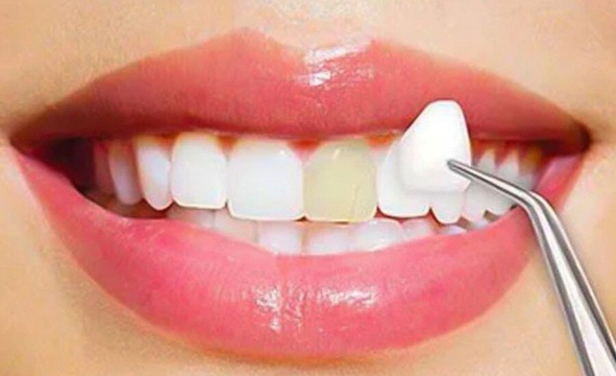 Cosmetic Dental